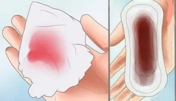 Chảy máu sau mãn kinh: Nguyên nhân và khi nào cần khám?